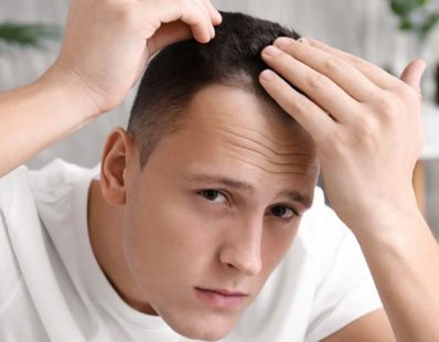 Scalp Micro Pigmentation